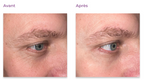 Peptilux - Crème anti-rides pour les yeux à effet « shock action » avec LIPHASYN - 20 ml