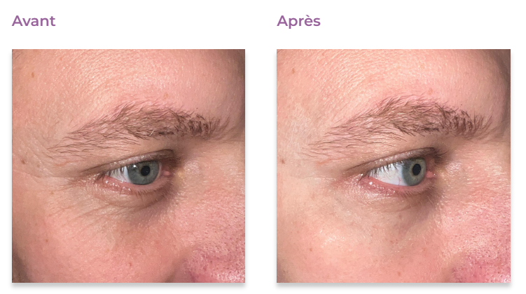 Peptilux - Crème anti-rides pour les yeux à effet « shock action » avec LIPHASYN - 20 ml