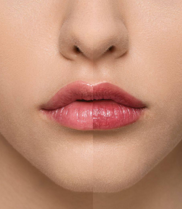 Supreme Lip Treatment – Framboise